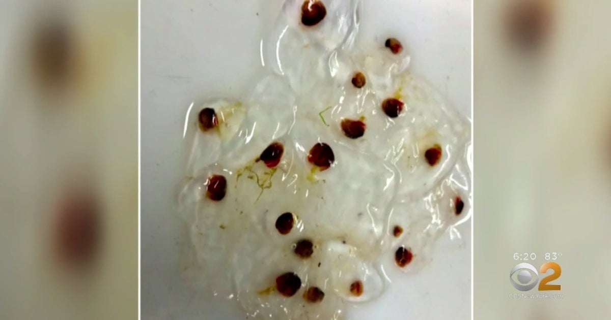 Jersey Shore Invaded By Tiny JellyfishLike Creatures CBS New York