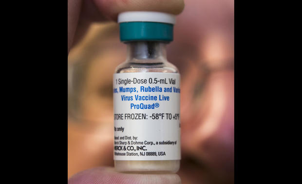 Measles Outbreak 