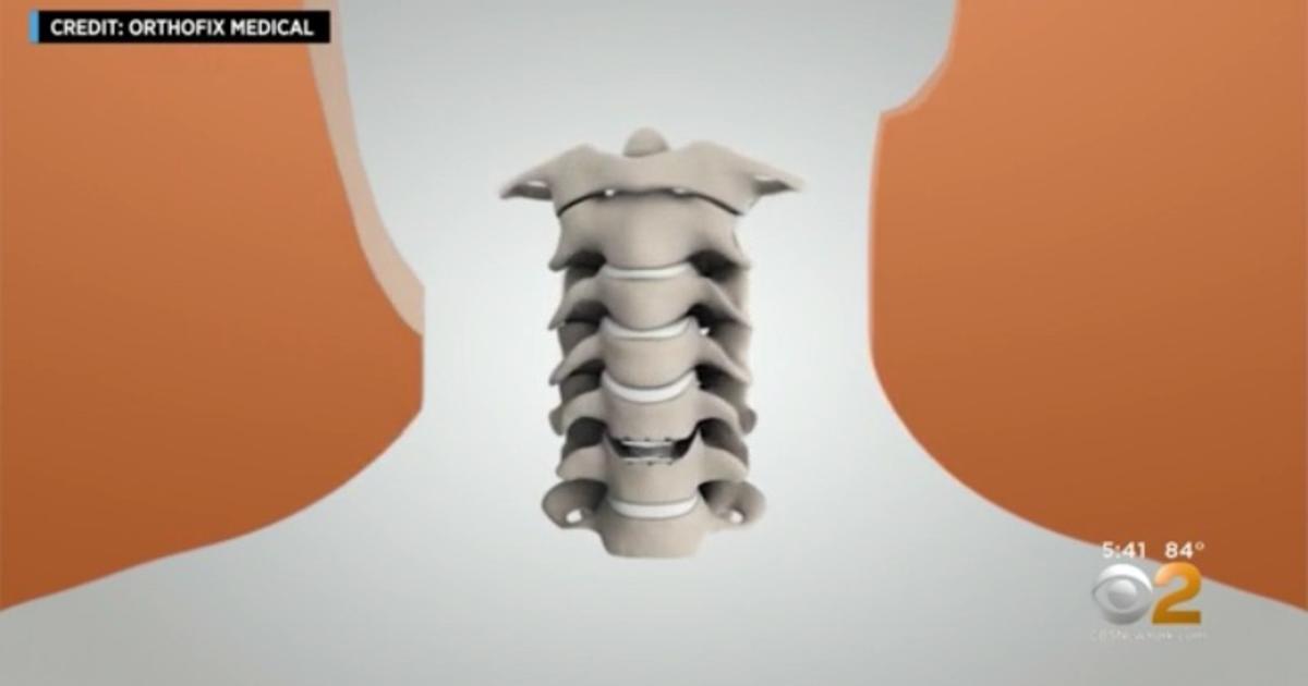 Neck massage machine can kill, FDA says - CBS News