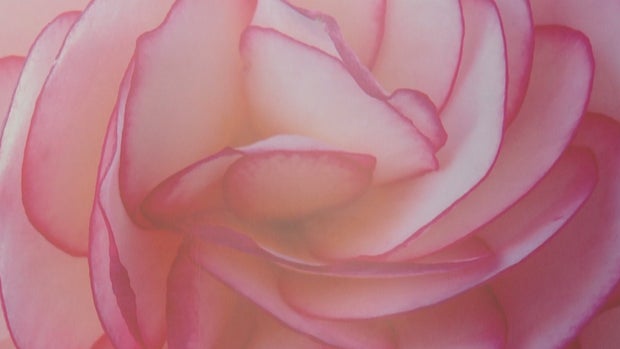 CORNEA TRANSPLANT PHOTOS 5PKG_frame_214 