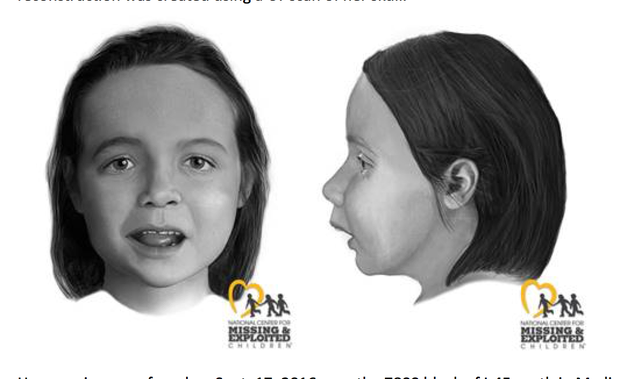 Facial reconstruction 