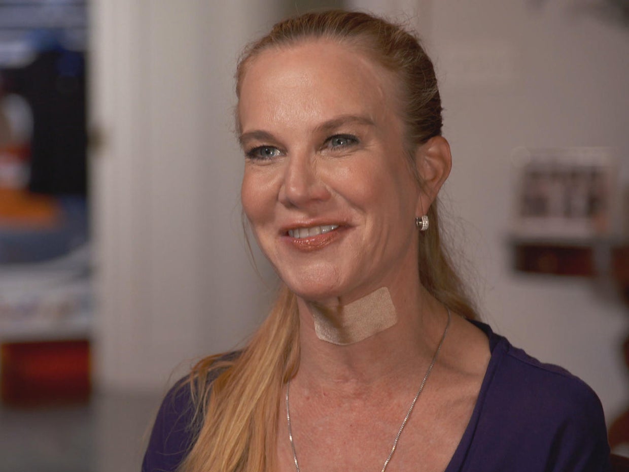 Jeannie's story Jim Gaffigan on his wife's brain tumor CBS News