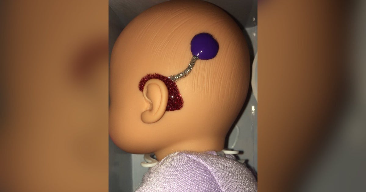 California Teacher Designs Glittery Hearing Aids On Dolls To Make Her