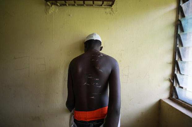 A 14 year-old-boy, one of hundreds of men and boys rescued by police from an institution purporting to be an Islamic school, reveals scars on his back at a transit camp set up to take care of the released captives in Kaduna 