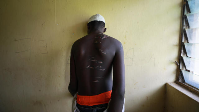 A 14 year-old-boy, one of hundreds of men and boys rescued by police from an institution purporting to be an Islamic school, reveals scars on his back at a transit camp set up to take care of the released captives in Kaduna 