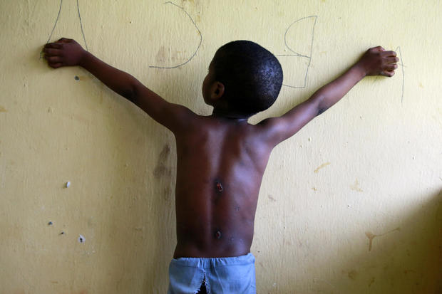 A 6 year-old-boy, one of hundreds of men and boys rescued by police from an institution purporting to be an Islamic school, reveals scars on his back at a transit camp set up to take care of the released captives in Kaduna 