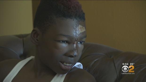 charter school kid beaten 