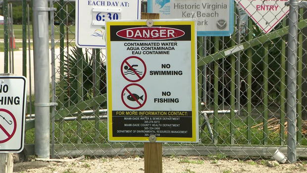 Virginia Key Water Advisory Sign 
