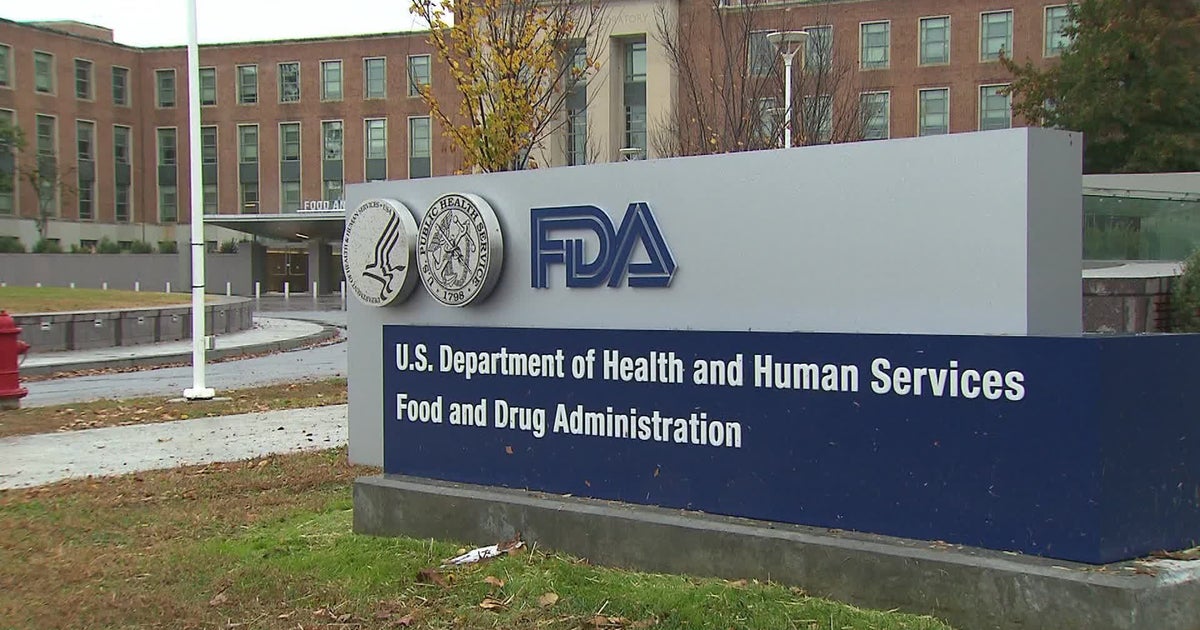 FDA warns of false negative results for food allergies after skin test recall