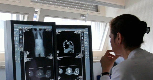 The movement against over-treating cancer