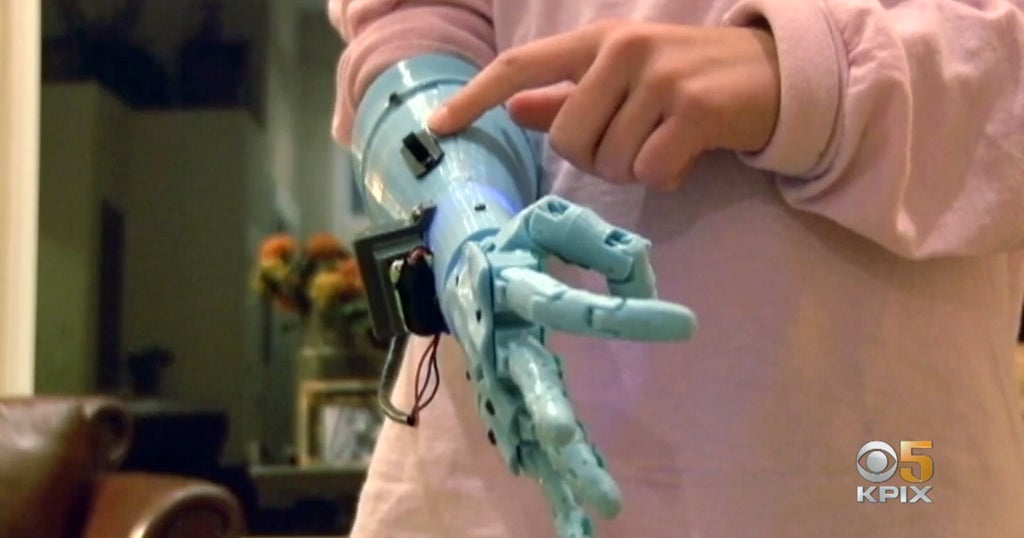 Surgeons Test New Wearable Tech That Helps Measure Operating Skills ...