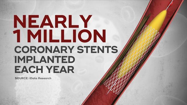 1118-en-heartstents-narula-1979724-640x360.jpg 