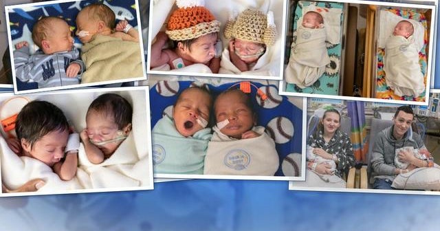 12 sets of twins born at one Missouri hospital