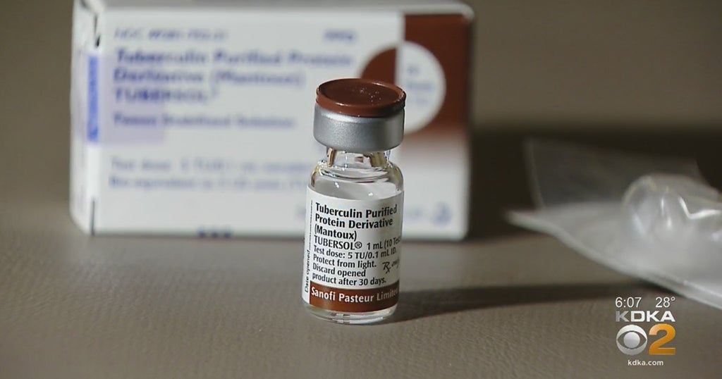 CenturyOld Tuberculosis Vaccine May Work Better If Given In New Way