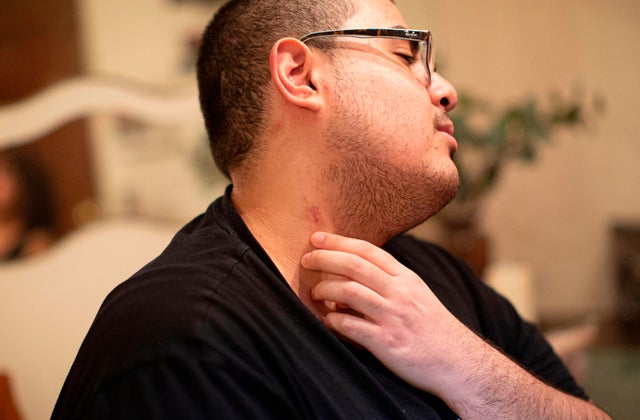 US-vaping-health-illness 