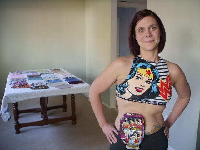 I Design My Own Ostomy Bags To Feel Sexy 