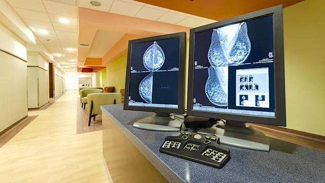 Mammogram-1064277246.jpg 