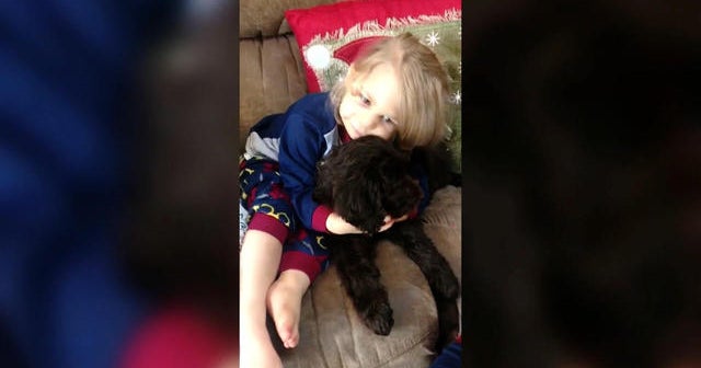 Therapy dog helps 2-year-old heart recipient recover after surgeries