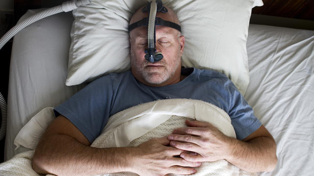 File photo of a woman wearing a CPAP mask for treating sleep apnea 