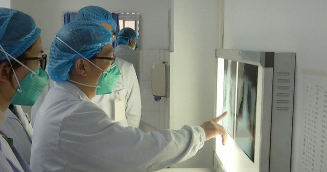 Officials worry deadly coronavirus in China could spread to U.S.