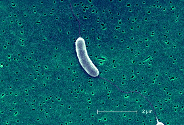 Vibrio Vulnificus 