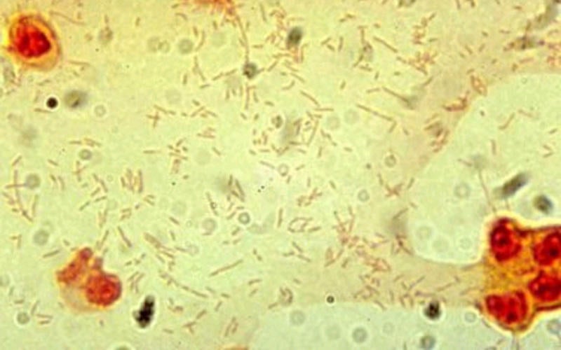 hinfluenzae-cdc.jpg 