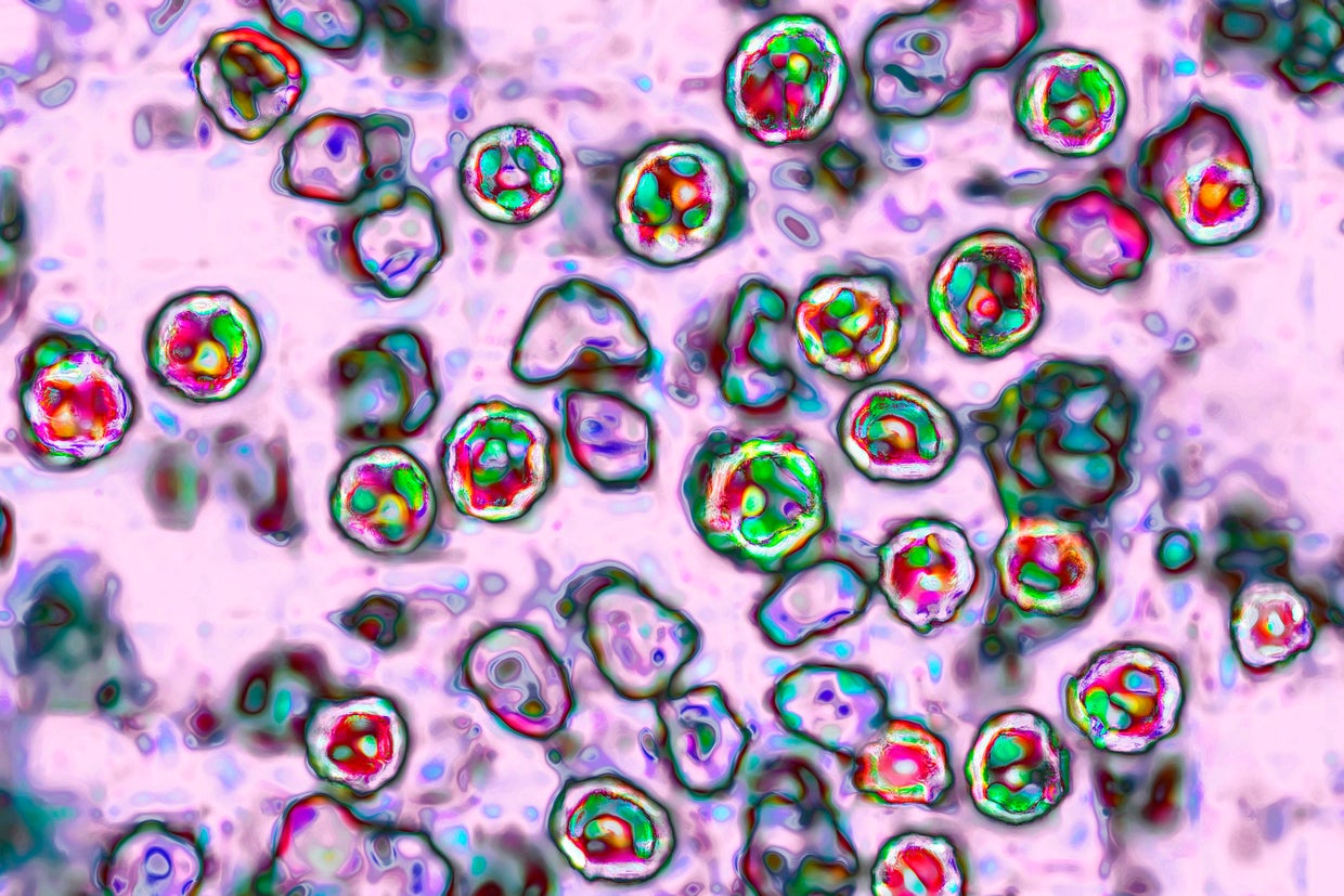 Measles Virus 
