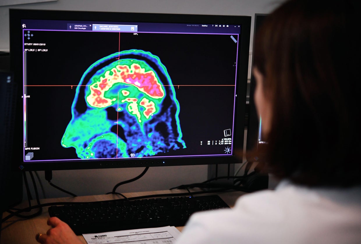 FRANCE-HEALTH-HOSPITAL-SCIENCE-RESEARCH 