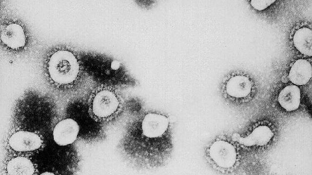 coronavirus-cdc.jpg 