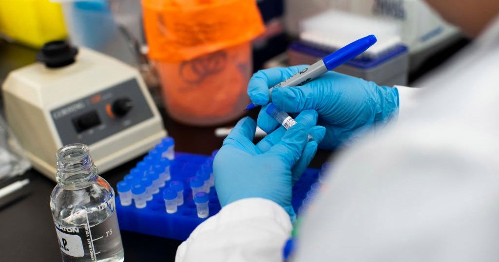 Woman With Coronavirus Is Santa Clara County's Fourth Case - CBS Sacramento