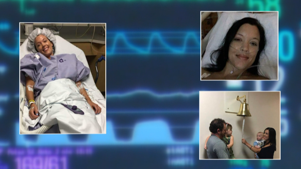 YOUNG COLON CANCER PATIENT 