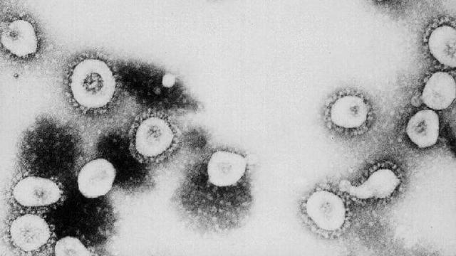 CDC Says SARS Might Be A Form Of The Coronavirus 