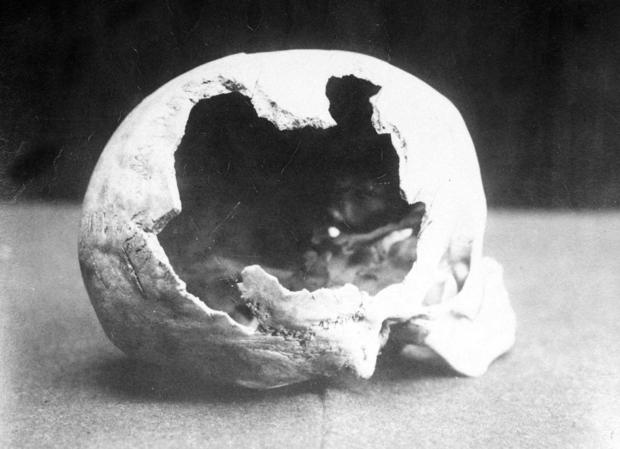 borden11-abby-skull.jpg 