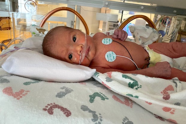 garcia twins 1 coronavirus 