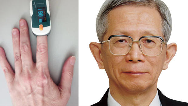 takuo-aoyagi-inventor-of-pulse-oximeter-620.jpg 
