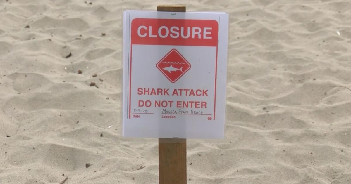 California surfer injured in shark attack thumbnail