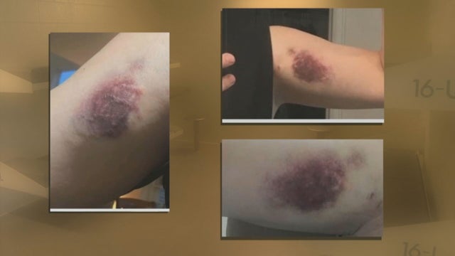 7 DEPUTIES INJURED PKG.transfer_frame_1150 