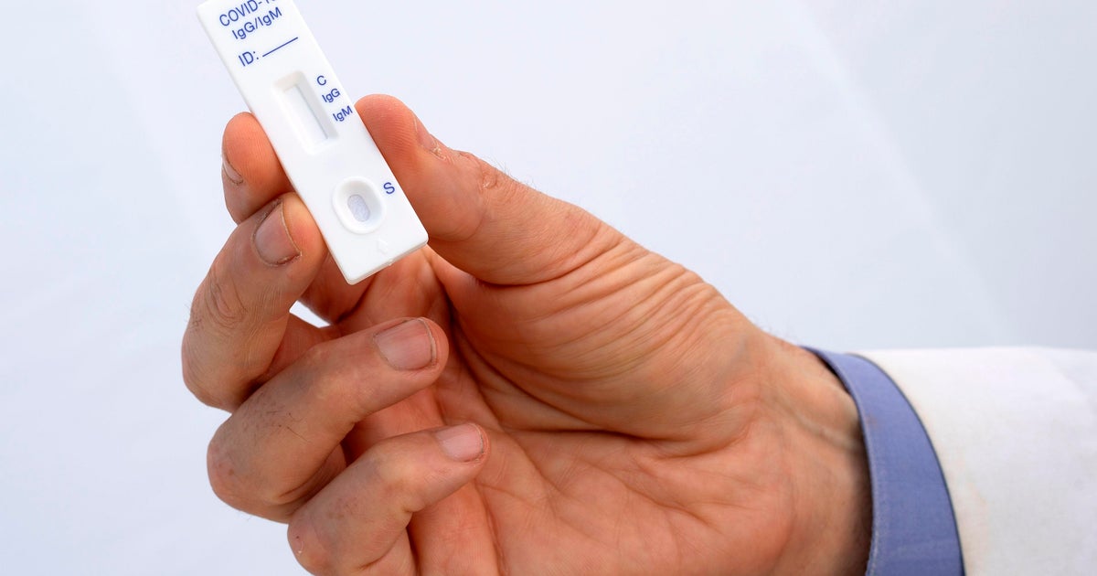 CDC warns antibody testing still too inaccurate to use for coronavirus ...
