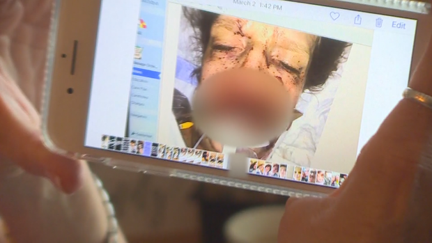 FRI0295 SPLFORKCNCPKGCOWome_frame_1232 