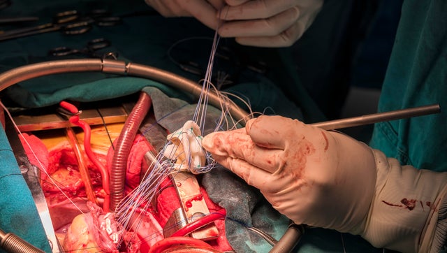 Most expensive medical procedures in the U.S., without insurance