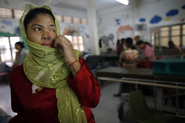 Acid Violence A Growing Threat In Cambodia 