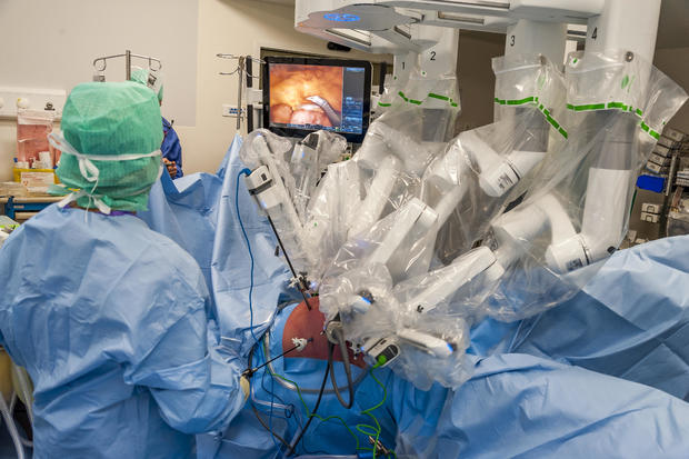 Opération chirurgicale robotisée 