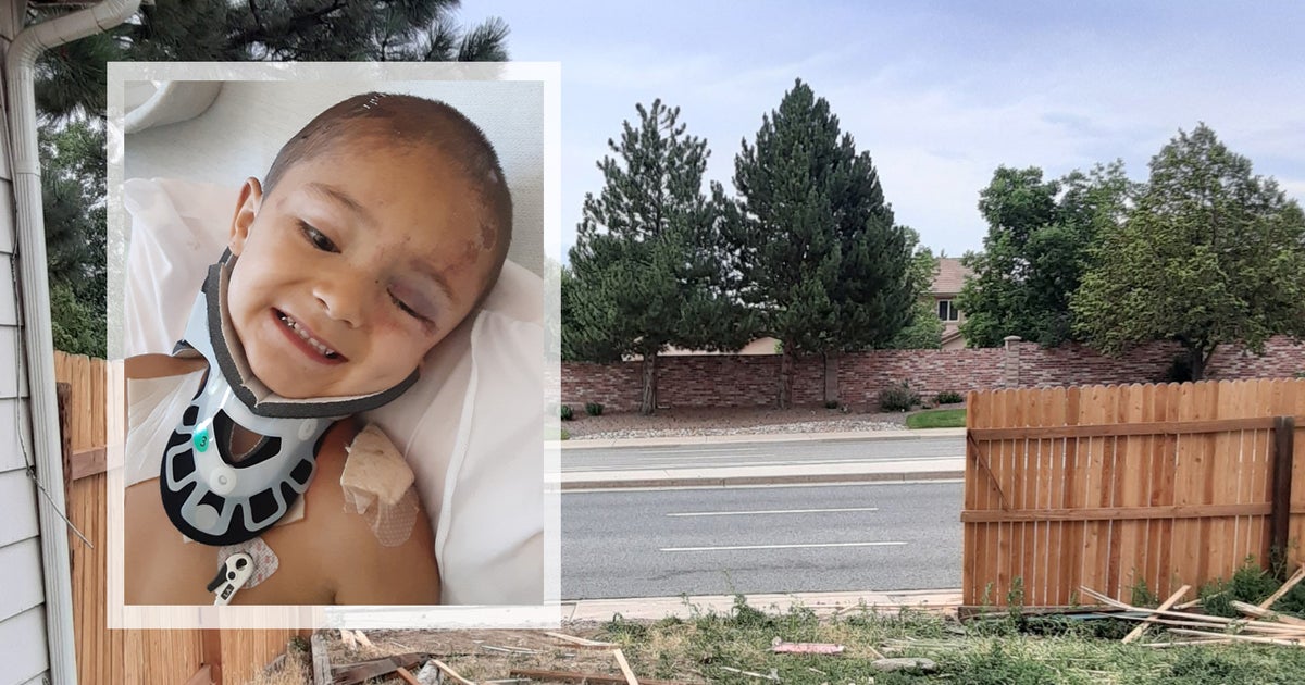 Boy Playing In Backyard Hurt After Crash Forces Truck Through Fence ...