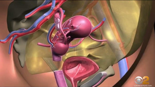 uterus-1.jpg 
