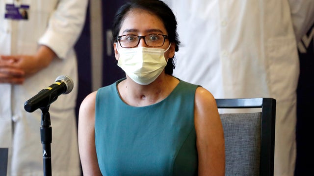 Virus Outbreak Transplant 