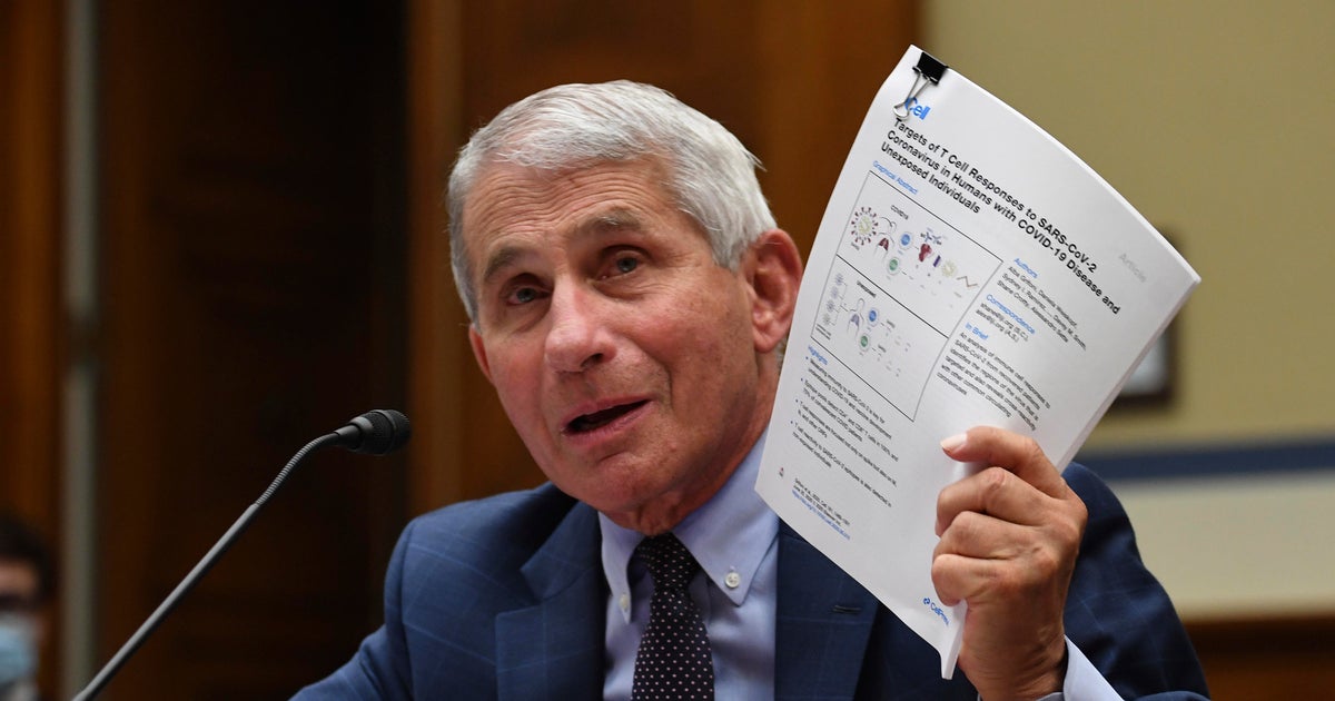 Fauci at home recovering from surgery to remove polyp on vocal cord(01)