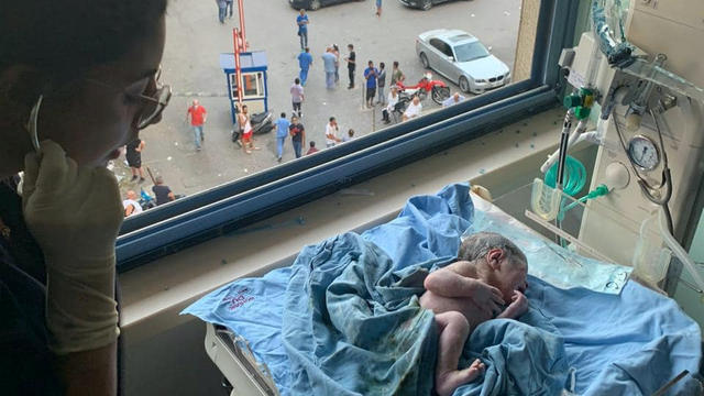 George, a boy that was born as the blast wave hit the hospital, is seen after birth in Beirut 