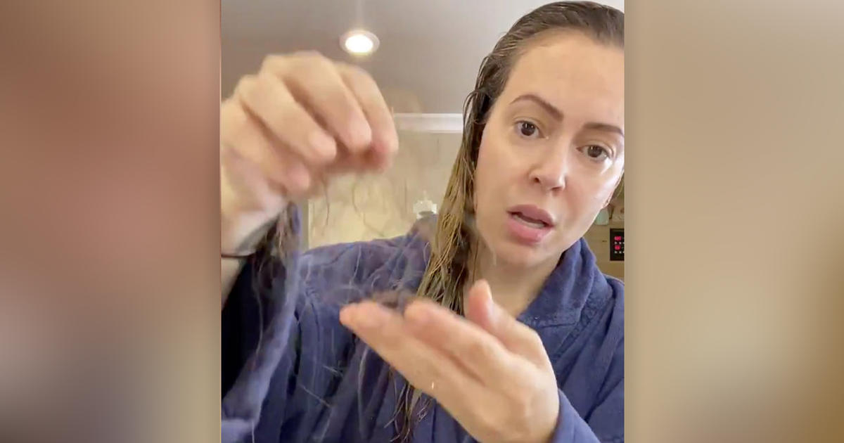 Alyssa Milano says she is losing her hair after long battle with COVID-19 -  CBS News