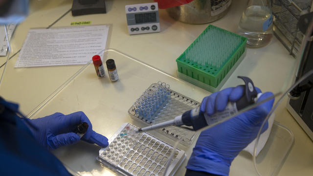 University Of Washington Medicine Tests Blood Of Recovered COVID-19 Patients For Antibodies 