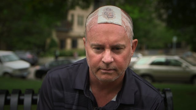 Shannon-Grendahl-Bullet-Grazed-Head-Near-Loring-Park.jpg 